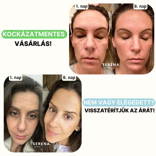 SERENA Bőrfeszesítő és Ráncfinomító készülék