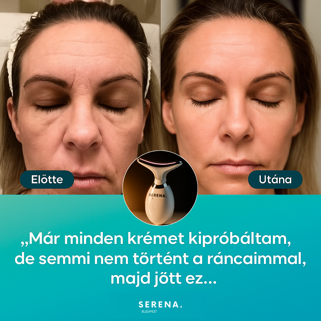 SERENA Bőrfeszesítő és Ráncfinomító készülék