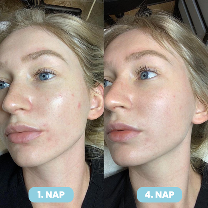 SERENA Bőrfeszesítő Maszk – Ráncfinomító Technológiával