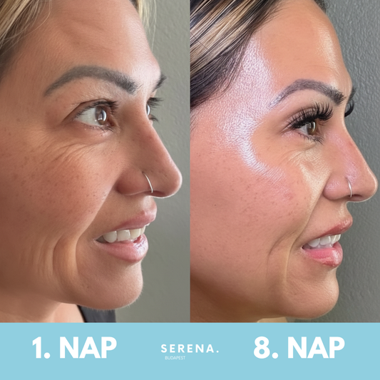 SERENA Bőrfeszesítő és Ráncfinomító készülék