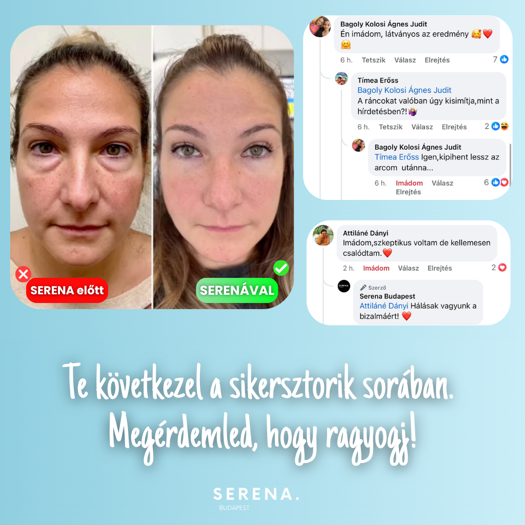 SERENA Bőrfeszesítő és Ráncfinomító készülék