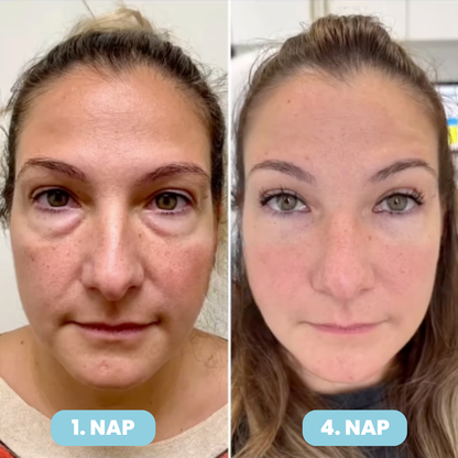 SERENA Bőrfeszesítő Maszk – Ráncfinomító Technológiával